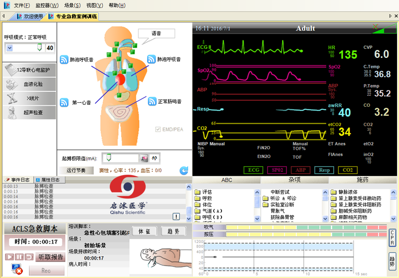  高智能數(shù)字化綜合急救技能訓(xùn)練系統(tǒng)（ACLS高級(jí)生命支持、計(jì)算機(jī)軟件控制）